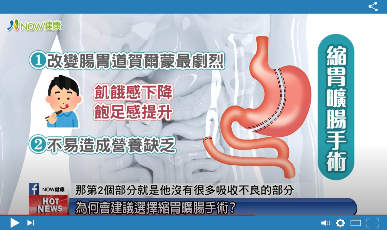 糖尿病減重_影片拍攝1
